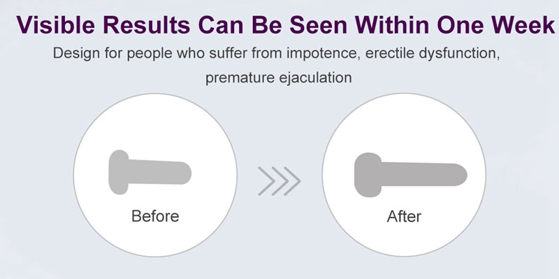 Bơm hút dương vật tăng kích thước cup kéo dài an toàn hiệu quả