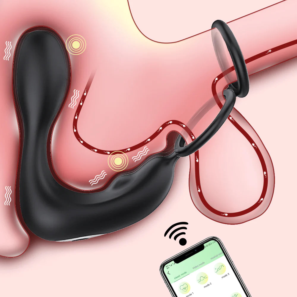 AP33 Rung Đâm Tiền Liệt App Điều Khiển Khoái Nam Đỉnh