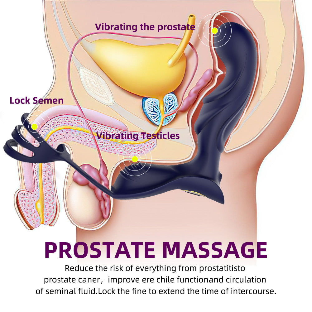 CHIQING I Prostate Plug Rung Remote Massage Thoải Mái