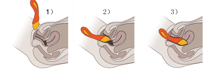 Zini Bloom G-Spot Rung Sưởi 23.5° Thoải Mái Đỉnh Cao